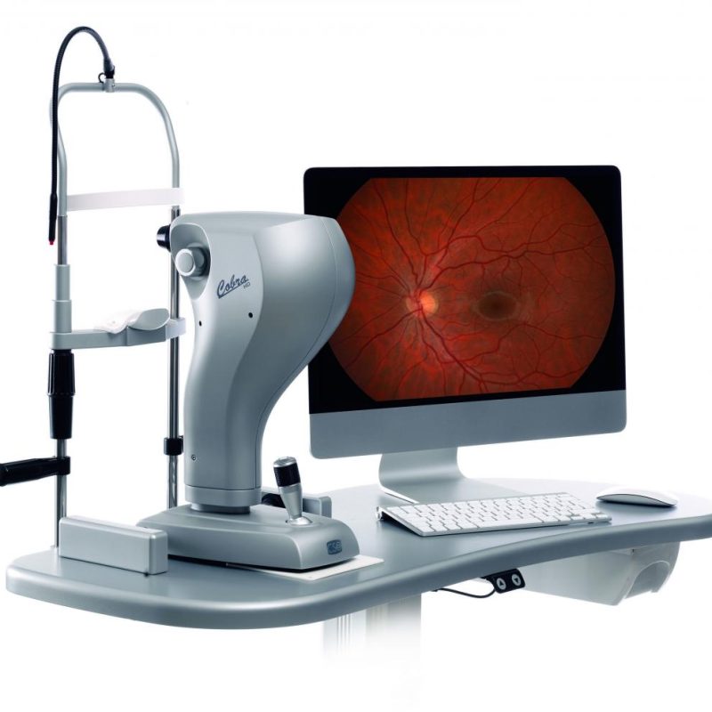 COBRA  FUNDUS CAMERA